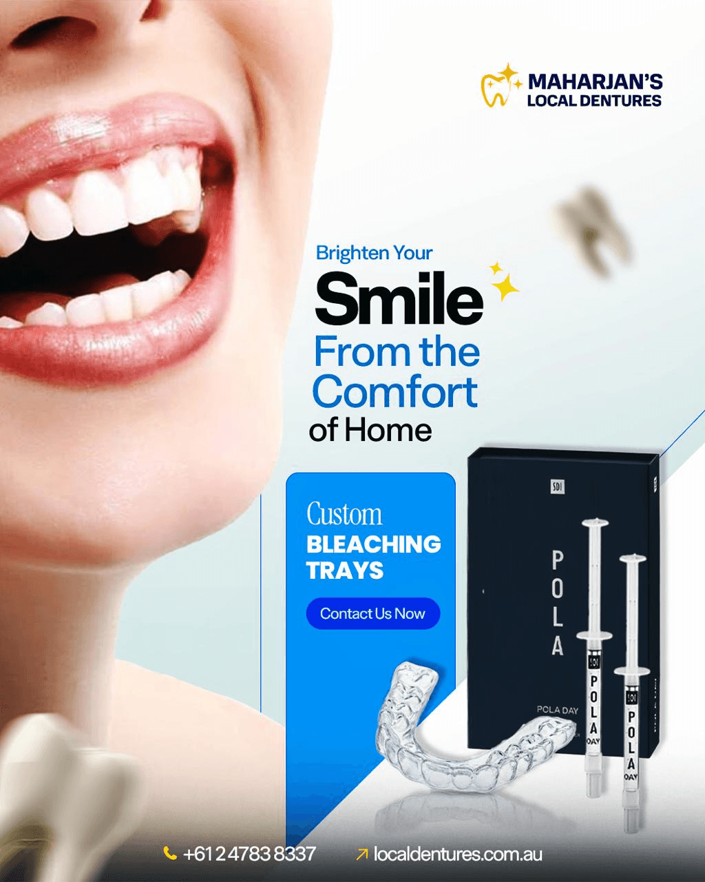custom bleaching trays